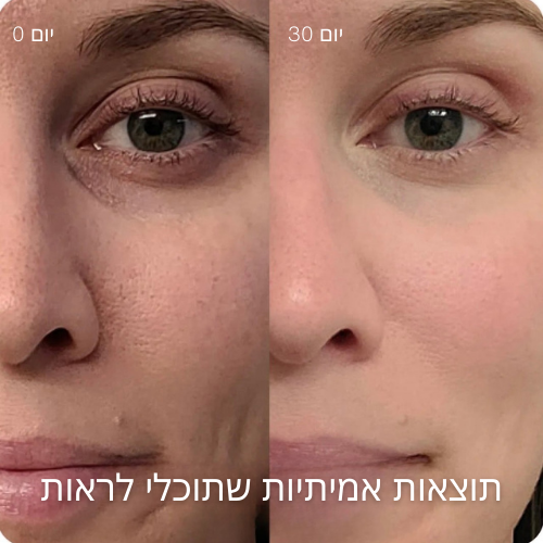 טיפוח עור מתקדם 4-ב-1 עם טכנולוגיית אור אדום