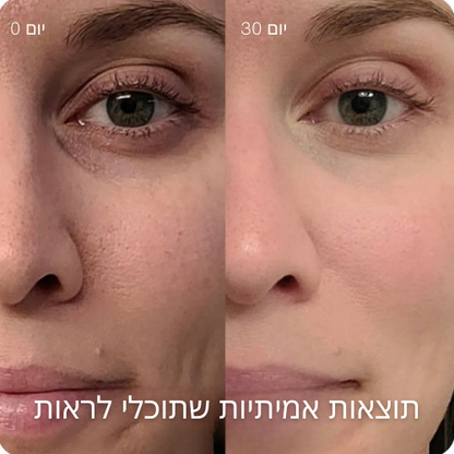 טיפוח עור מתקדם 4-ב-1 עם טכנולוגיית אור אדום