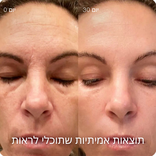 טיפוח עור מתקדם 4-ב-1 עם טכנולוגיית אור אדום