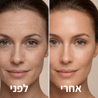 solawine - החלקת העור ללא מחטים